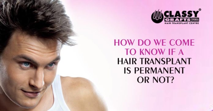 How Can We Determine the Long-Term Efficacy of a Hair Transplant?